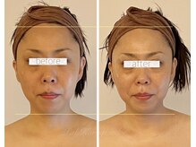 パル コルギサロン(Pal. Korugi salon)/コルギビフォーアフター