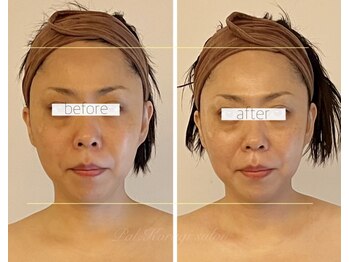 パル コルギサロン(Pal. Korugi salon)/コルギビフォーアフター