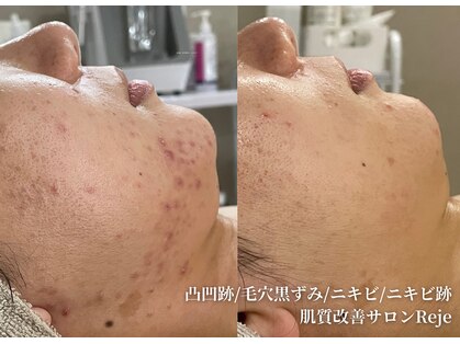 リジュ(Reje)の写真