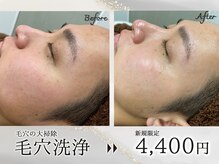 アモール 丸亀店(Amor)の雰囲気（お肌のくすみの元になる汚れを徹底的に洗浄♪艶肌へ導きます♪）