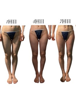 痩身革命 大宮店/ダイエットリンパマッサージ