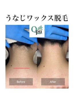 キュープ 下北沢店(Qpu)/ビフォーアフター