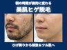痛みが少ないけど効果◎美肌ヒゲ脱毛★初回5,000円