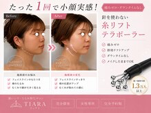 ティアラ(TIARA)