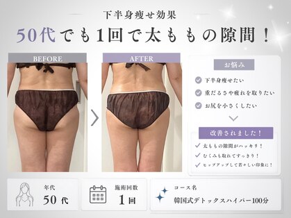 ミヨンラボ(miyon LABO)の写真