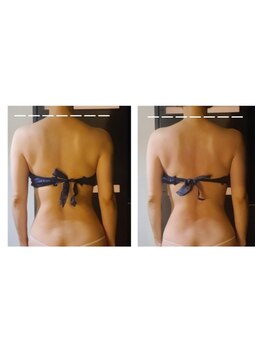 アンドゥ 津田沼(Undo)/【肩こり・頭痛】などの不調に!