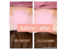 シークレットゾーンの？？驚愕のbeforeーafter