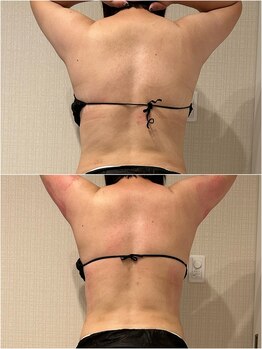 シェリール(CHIRIEUR)/お急ぎの方は1発集中!