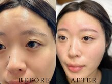 メラニー 元町中華街(melanie.)/アイブロウWAXデザイン