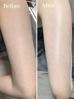 オーパーツ(OOPARTS)/ブライダルシェービング