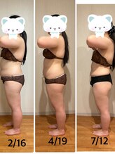 アルカンジュ(Archange)/ハイパー+EMS