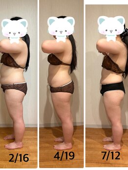 アルカンジュ(Archange)/ハイパー+EMS