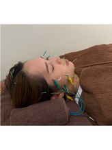 トイ鍼灸接骨院(TOY鍼灸接骨院)/●美容鍼