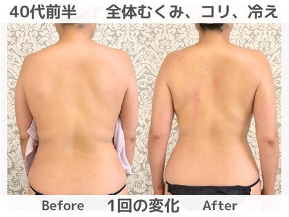 マテリアル 痩身骨気サロン(MATERIAL)の写真