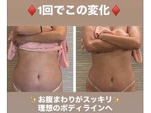リッチアンビューティー(Rich.an beauty)の雰囲気（痩身メニュー、ハイパーSDで内側から巡りを整え、若々しい印象へ）