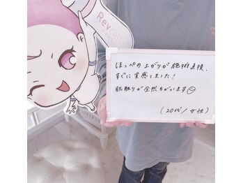 ウィンクドール(Wink Doll)/リブセラの感想