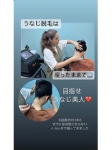 ルトゥール(Retour)/うなじ脱毛