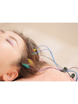 鍼灸施術を受けたい