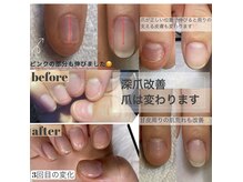 ミューネイル(mue nail)