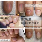 ミューネイル(mue nail)