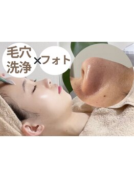 毛穴ケアをしたい