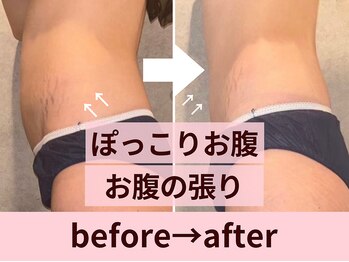 クイーンズチャーム(Queen's Charm)/パワーツリーお腹の変化★