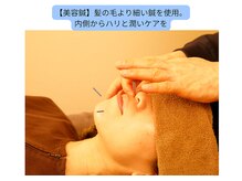 ここつ漢方薬店 二俣川院/美容鍼