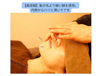 ここつ漢方薬店 二俣川院/美容鍼