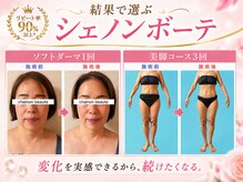 シェノンボーテ(chainon beaute)