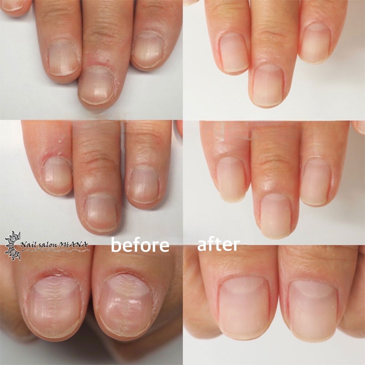 ÖHana nail 　おまとめ４点 クーポン・メニュー｜オハナ(OHANA)｜ホットペッパービューティー
