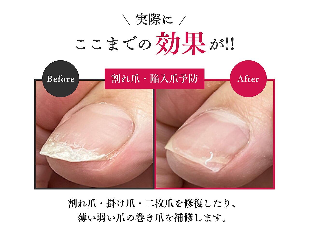 Dr.巻き爪 天神院|ホットペッパービューティー Dr.巻き爪 天神院|ホットペッパービューティー