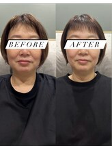 シロ(silo.)/メデューサと耳つぼbefore after