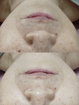 ビーユー(Be.you)/陶器肌コース