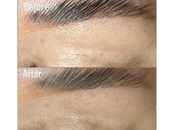 アールネイルズ(R Nails)/MinMin Wax脱毛