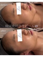 ユフラ(Juhla)/ララピール