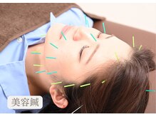 まろん鍼灸接骨院 立川店/美容鍼