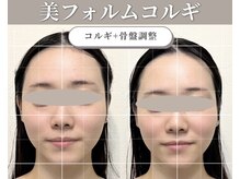 ジョワ(JOIE)の雰囲気（美フォルム◇小顔コルギ導入◇）