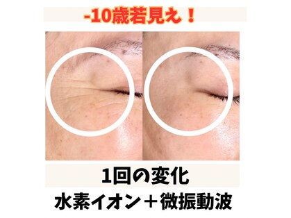 トータルビューティー雅の写真