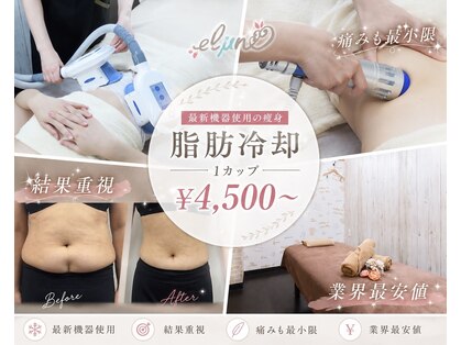 エルミューノ(elμno)の写真