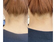 ネイル アンド アイラッシュ グレイス(Grace)/うなじWAX《トリートメント付》