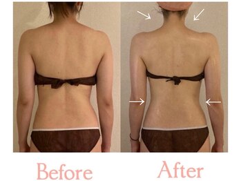 アティレ オオサカ(Attirer Osaka)/"ゴツゴツ背中"生まれ変わる