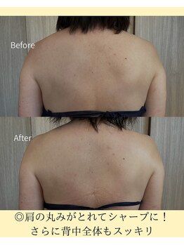 サクラ(SAKURA)/ビフォーアフター