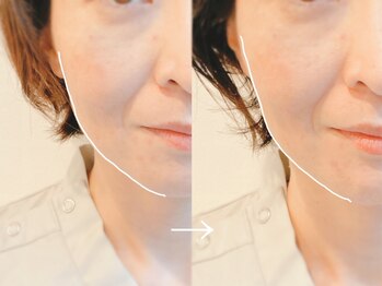 エルプラス(L+)/リフトアップコースで上げる！