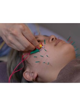 鍼灸施術を受けたい