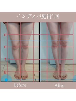 カノン(Kanon.)/インディバボディ