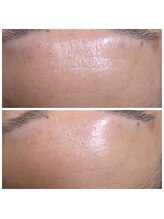 越前屋/TGFエッセンス