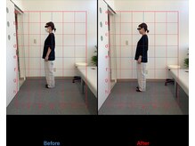 リード整骨院(LEAD整骨院)/姿勢改善、猫背、反り腰