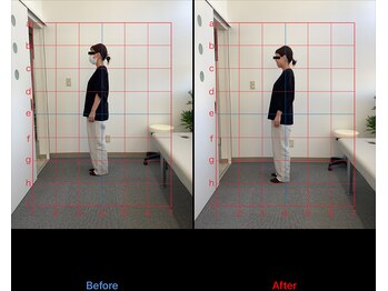 リード整骨院(LEAD整骨院)/姿勢改善、猫背、反り腰