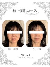エアケア(AirCare)/迷ったらコレ！極上美肌コース♪