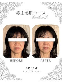 エアケア(AirCare)/迷ったらコレ！極上美肌コース♪